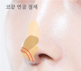 2번이미지