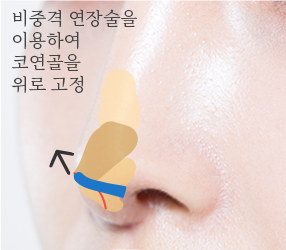 4번이미지