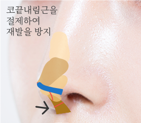 5번이미지