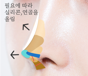6번이미지