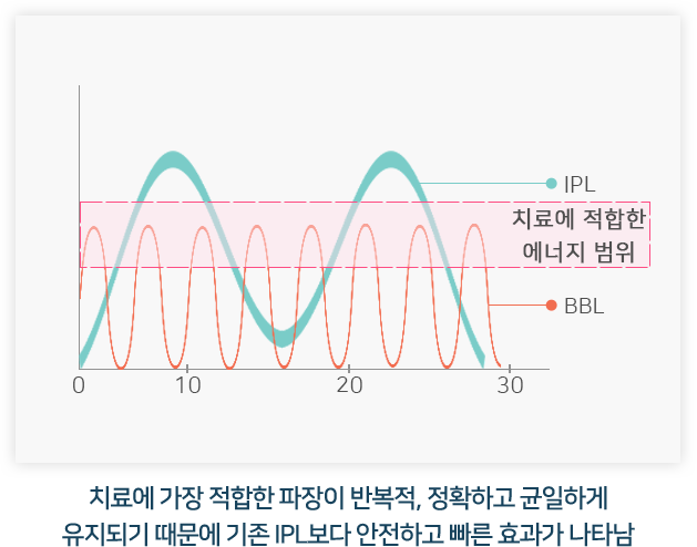 치료에 가장 적합한 파장이 반복적, 정확하고 균일하게 유지되기 때문에 기존 IPL보다 안전하고 빠른 효과가 나타남