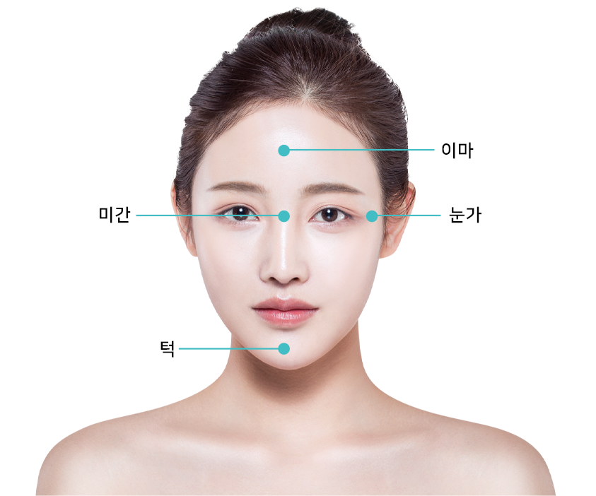 보톡스