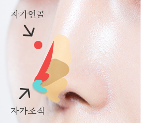 2번이미지