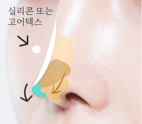 3번이미지