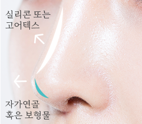 2번이미지