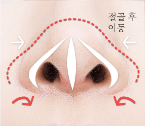 3번이미지