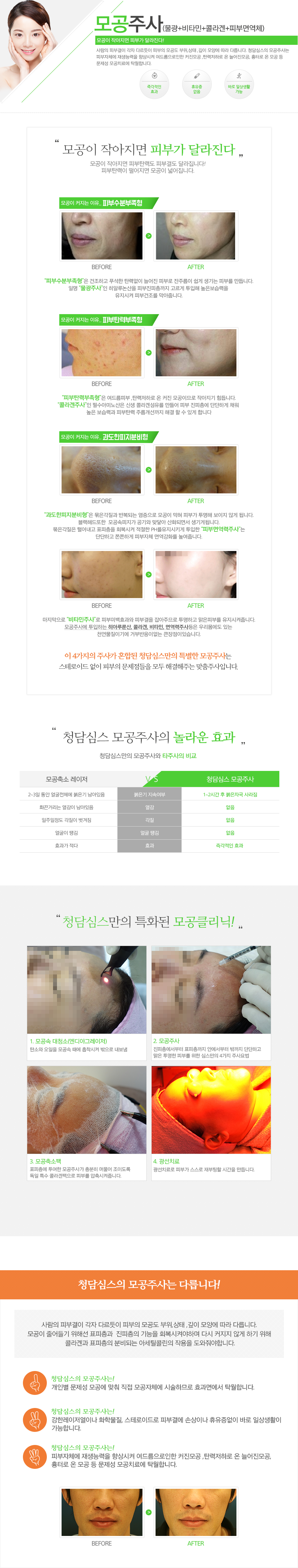 모공주사